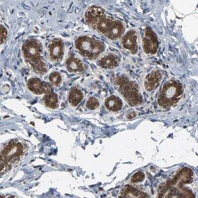 Immunohistochemistry-Paraffin: UbcH5b/UBE2D2 Antibody [NBP1-81769] - Staining of human breast shows cytoplasmic and nuclear positivity in glandular cells.