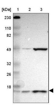 Western Blot: UbcH5b/UBE2D2 Antibody [NBP1-81769] - Lane 1: Marker  [kDa] 230, 110, 82, 49, 32, 26, 18.   Lane 2: Human cell line RT-4.  Lane 3: Human cell line U-251MG sp