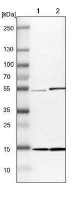 Western Blot: UbcH5b/UBE2D2 Antibody [NBP1-81769] -  Lane 1: NIH-3T3 cell lysate (Mouse embryonic fibroblast cells). Lane 2: NBT-II cell lysate (Rat Wistar bladder tumor cells).