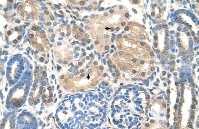 Immunohistochemistry-Paraffin: UBE2E2 Antibody [NBP1-55077] - Human kidney Tissue, antibody concentration 4-8ug/ml. Cells with positive label: renal corpuscle cells (indicated with arrows) 400X magnification.