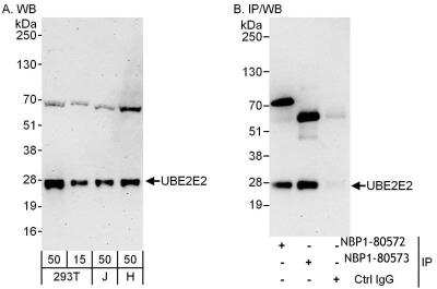 Immunoprecipitation: UBE2E2 Antibody [NBP1-80572] - Whole cell lysate from 293T (15 and 50 mcg for WB; 1 mg for IP, 20% of IP loaded), Jurkat (J; 50 mcg) and HeLa (H; 50 mcg) cells. Affinity purified rabbit anti-UBE2E2 antibody used for WB at 0.04 mcg/ml (A) and 0.4 mcg/ml (B) and used for IP at 6 mcg/mg lysate.  UBE2E2 was also immunoprecipitated by rabbit anti-UBE2E2 antibody NBP1-80572, which recognizes an upstream epitope.