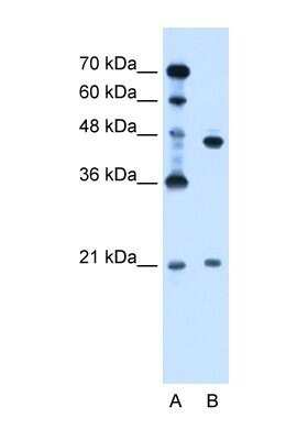 Western Blot: UBE2E2 Antibody [NBP1-55077] - Jurkat cell lysate, Antibody Titration: 0.125ug/ml