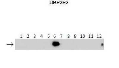 Western Blot: UBE2E2 Antibody [NBP1-55077] - Lanes: 1 : 40 ng HIS-UBE2D1 protein2: 40 ng HIS-UBE2D2 protein3: 40 ng HIS-UBE2D3 protein4: 40 ng HIS-UBE2D4 protein5: 40 ng HIS-UBE2E1 protein6: 40 ng HIS-UBE2E2 protein7: 40 ng HIS-UBE2E3 protein8: 40 ng HIS-UBE2K protein9: 40 ng HIS-UBE2L3 protein10: 40 ng HIS-UBE2N protein11 : 40 ng HIS-UBE2V1 protein12: 40 ng HIS-UBE2V2 protein. Primary Antibody Dilution: 1 : 500 Secondary Antibody: Anti-rabbit-HRP Secondary Antibody Dilution: 1 : 50,000 Gene name: UBE2E2 Submitted by: Dr Chris Boutell. MRC-UoG Centre for Virus Research (CVR), UK.