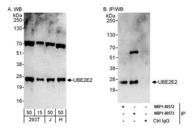 Western Blot: UBE2E2 Antibody [NBP1-80573] - Detection of human UBE2E2 by western blot and immunoprecipitation. Samples: Whole cell lysate from HEK293T (15 and 50 ug for WB; 1 mg for IP, 20% of IP loaded), Jurkat (J; 50 ug) and HeLa (H; 50 ug) cells. Antibodies: Affinity purified rabbit anti-UBE2E2 antibody NBP1-80573 used for WB at 0.04 ug/ml (A) and 0.4 ug/ml (B) and used for IP at 6 ug/mg lysate. UBE2E2 was also immunoprecipitated by rabbit anti-UBE2E2 antibody NBP1-80572, which recognizes an upstream epitope. Detection: Chemiluminescence with exposure times of 3 minutes (A) and 10 seconds (B).