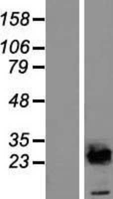 Western Blot: UBE2E2 Overexpression Lysate (Adult Normal) [NBL1-17524] Left-Empty vector transfected control cell lysate (HEK293 cell lysate); Right -Over-expression Lysate for UBE2E2.