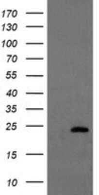 Western Blot: UBE2E3 Antibody (1B4) [NBP2-46271] - Analysis of HEK293T cells were transfected with the pCMV6-ENTRY control (Left lane) or pCMV6-ENTRY UBE2E3.