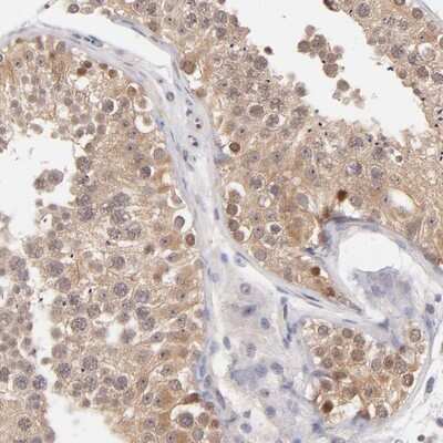 Immunohistochemistry-Paraffin: UBE2E3 Antibody [NBP1-86884] - Staining of human testis shows cytoplasmic and nuclear positivity in cells in seminiferus ducts.