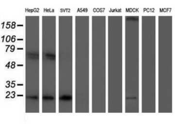 Western Blot: UBE2E3 Antibody (OTI1B4) - Azide and BSA Free [NBP2-74737] - Analysis of extracts (35ug) from 9 different cell lines (HepG2: human; HeLa: human; SVT2: mouse; A549: human; COS7: monkey; Jurkat: human; MDCK: canine; PC12: rat; MCF7: human).