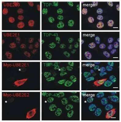 Immunohistochemistry: UBE2E3 Antibody (OTI7E8) - Azide and BSA Free [NBP2-74745] - (Negative UBE2E3 protein level by using anti-UBE2E3 antibody in HEK293E cells. Dilution: 1:150-500
