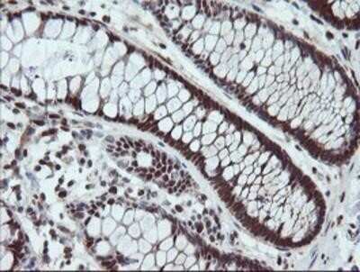 Immunohistochemistry: UBE2E3 Antibody (OTI7E8) - Azide and BSA Free [NBP2-74745] - Staining of paraffin-embedded Human colon tissue using anti-UBE2E3 mouse monoclonal antibody.