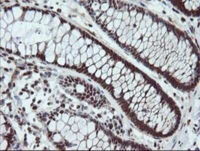 Immunohistochemistry-Paraffin: UBE2E3 Antibody (OTI7E8) [NBP2-03819] - Staining of paraffin-embedded Human colon tissue using anti-UBE2E3 mouse monoclonal antibody.