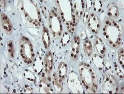 Immunohistochemistry-Paraffin: UBE2E3 Antibody (OTI7E8) [NBP2-03819] - Staining of paraffin-embedded Human Kidney tissue using anti-UBE2E3 mouse monoclonal antibody.