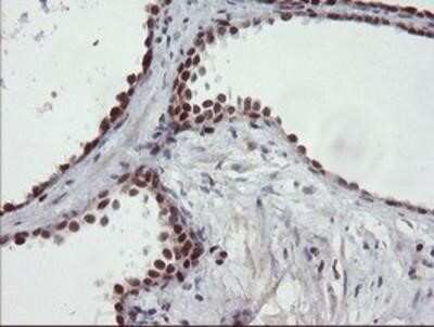 Immunohistochemistry-Paraffin: UBE2E3 Antibody (OTI7E8) [NBP2-03819] - Staining of paraffin-embedded Human prostate tissue using anti-UBE2E3 mouse monoclonal antibody.