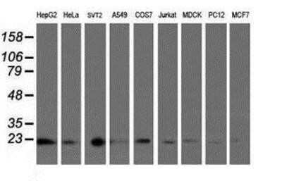 Western Blot: UBE2E3 Antibody (OTI7E8) [NBP2-03819] - Analysis of extracts (35ug) from 9 different cell lines by usin g anti-UBE2E3 monoclonal antibody (HepG2: human; HeLa: human; SVT2: mouse; A549: human; COS7: monkey; Jurkat: human; MDCK: canine; PC12: rat; MCF7: human).