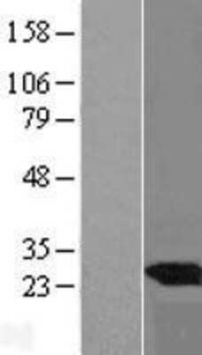 Western Blot UBE2E3 Overexpression Lysate