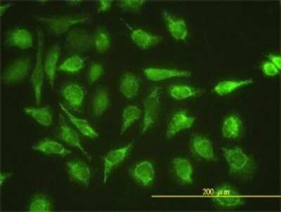 Immunocytochemistry/Immunofluorescence: UBE2G1 Antibody (1C12-1B2) [H00007326-M01] - Analysis of monoclonal antibody to UBE2G1 on HeLa cell. Antibody concentration 20 ug/ml.