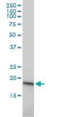 Western Blot: UBE2G1 Antibody (1C12-1B2) [H00007326-M01] - UBE2G1 expression in Hela ( Cat # L013V1 ).