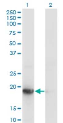 Western Blot: UBE2G1 Antibody (1C12-1B2) [H00007326-M01] - Analysis of UBE2G1 expression in transfected 293T cell line by UBE2G1 monoclonal antibody (M01), clone 1C12-1B2.Lane 1: UBE2G1 transfected lysate (Predicted MW: 19.5 KDa).Lane 2: Non-transfected lysate.