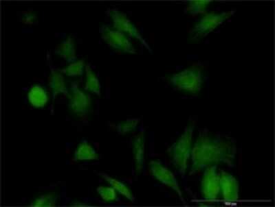 Immunocytochemistry/Immunofluorescence: UBE2G1 Antibody (2A9-1F11) [H00007326-M02] - Analysis of monoclonal antibody to UBE2G1 on HeLa cell . Antibody concentration 20 ug/ml.