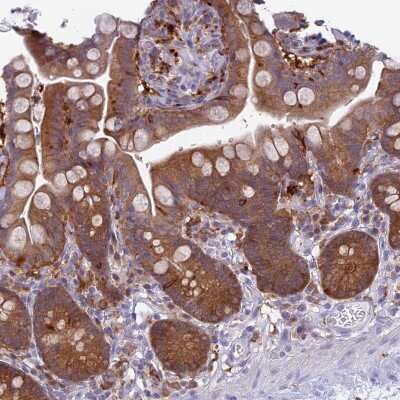 Immunohistochemistry-Paraffin: UBE2G1 Antibody [NBP2-13499] - Staining of human colon shows strong cytoplasmic positivity in glandular cells.