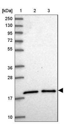 Western Blot: UBE2G1 Antibody [NBP2-13499] - Lane 1: Marker  (kDa) 250, 130, 95, 72, 55, 36, 28, 17, 10.  Lane 2: Human cell line RT-4.  Lane 3: Human cell line U-251MG sp