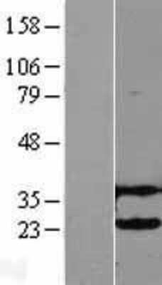 Western Blot: UBE2H Overexpression Lysate (Adult Normal) [NBL1-17531] - Western Blot experiments.  Left-Control; Right -Over-expression Lysate for UBE2H.