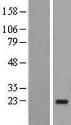 Western Blot: UBE2I Overexpression Lysate (Adult Normal) [NBL1-17532] Left-Empty vector transfected control cell lysate (HEK293 cell lysate); Right -Over-expression Lysate for UBE2I.