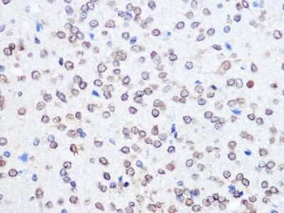 Immunohistochemistry-Paraffin: UBE2I/Ubc9 Antibody (6Z9V6) [NBP3-16400] - Immunohistochemistry of paraffin-embedded rat brain using UBE2I/Ubc9 Rabbit mAb (NBP3-16400) at dilution of 1:100 (40x lens).Perform microwave antigen retrieval with 10 mM PBS buffer pH 7.2 before commencing with IHC staining protocol.