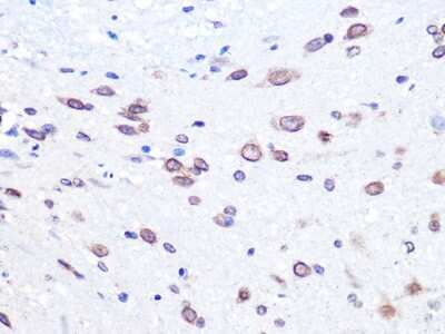 Immunohistochemistry-Paraffin: UBE2I/Ubc9 Antibody (6Z9V6) [NBP3-16400] - Immunohistochemistry of paraffin-embedded mouse spinal cord using UBE2I/Ubc9 Rabbit mAb (NBP3-16400) at dilution of 1:100 (40x lens).Perform microwave antigen retrieval with 10 mM PBS buffer pH 7.2 before commencing with IHC staining protocol.