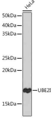 Western Blot: UBE2I/Ubc9 Antibody (6Z9V6) [NBP3-16400] - Western blot analysis of extracts of HeLa cells, using UBE2I/Ubc9 Rabbit mAb (NBP3-16400) at 1:1000 dilution. Secondary antibody: HRP Goat Anti-Rabbit IgG (H+L) at 1:10000 dilution. Lysates/proteins: 25ug per lane. Blocking buffer: 3% nonfat dry milk in TBST. Detection: ECL Basic Kit. Exposure time: 30s.