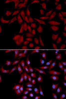 Immunocytochemistry/Immunofluorescence: UBE2I/Ubc9 Antibody [NBP2-95142] - Analysis of U2OS cells using UBE2I/Ubc9 . Blue: DAPI for nuclear staining.