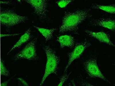 Immunocytochemistry/Immunofluorescence: UBE2I/Ubc9 Antibody [NBP3-00096] - Immunofluorescence staining of UBE2I/Ubc9 in HeLa cells. Cells were fixed with 4% PFA, permeabilzed with 0.3% Triton X-100 in PBS, blocked with 10% serum, and incubated with rabbit anti-human UBE2I/Ubc9 polyclonal antibody (dilution ratio 1:1000) at 4C overnight. Then cells were stained with the Alexa Fluor(R)488-conjugated Goat Anti-rabbit IgG secondary antibody (green).Positive staining was localized to cytoplasm and nucleus.