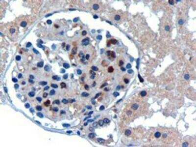 Immunohistochemistry-Paraffin: UBE2I/Ubc9 Antibody [NB300-812] - Staining of Human Kidney. Antibody at 0.3 ug/mL. Microwaved antigen retrieval with Tris/EDTA buffer pH9, HRP-staining.