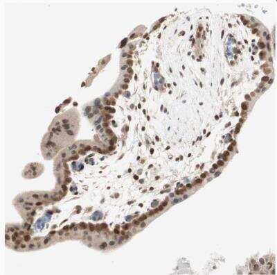 Immunohistochemistry-Paraffin: UBE2I/Ubc9 Antibody [NBP1-86887] - Staining of human placenta shows moderate to strong nuclear positivity in trophoblastic cells.