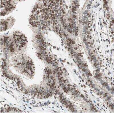 Immunohistochemistry-Paraffin: UBE2I/Ubc9 Antibody [NBP1-86887] - Staining of human fallopian tube shows moderate to strong nuclear positivity in glandular cells.