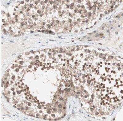 Immunohistochemistry-Paraffin: UBE2I/Ubc9 Antibody [NBP1-86887] - Staining of human testis shows moderate to strong nuclear positivity in cells in seminiferous ducts.