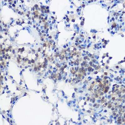 Immunohistochemistry-Paraffin: UBE2I/Ubc9 Antibody [NBP2-93799] - Immunohistochemistry of paraffin-embedded rat lung using UBE2I/Ubc9 Rabbit pAb (NBP2-93799) at dilution of 1:100 (40x lens). Perform high pressure antigen retrieval with 10 mM citrate buffer pH 6.0 before commencing with IHC staining protocol.