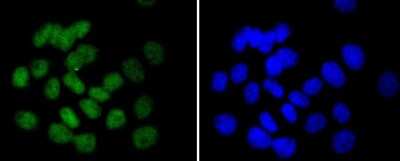 Immunocytochemistry/Immunofluorescence: UBE2I/Ubc9 Antibody (SC0534) [NBP2-67564] - Staining UBC9 in A431 cells (green). The nuclear counter stain is DAPI (blue). Cells were fixed in paraformaldehyde, permeabilised with 0.25% Triton X100/PBS.