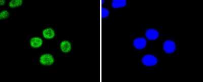 Immunocytochemistry/Immunofluorescence: UBE2I/Ubc9 Antibody (SC0534) [NBP2-67564] - Staining UBC9 in HepG2 cells (green). The nuclear counter stain is DAPI (blue). Cells were fixed in paraformaldehyde, permeabilised with 0.25% Triton X100/PBS.