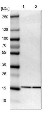 Western Blot: UBE2I/Ubc9 Antibody [NBP1-86887] - Lane 1: NIH-3T3 cell lysate (Mouse embryonic fibroblast cells); Lane 2: NBT-II cell lysate (Rat Wistar bladder tumour cells).