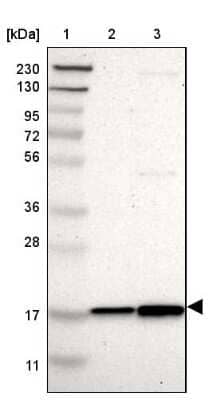 Western Blot: UBE2I/Ubc9 Antibody [NBP1-86887] - Lane 1: Marker [kDa] 230, 130, 95, 72, 56, 36, 28, 17, 11Lane 2: Human cell line RT-4Lane 3: Human cell line U-251MG sp