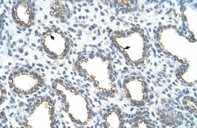 Immunohistochemistry: UBE2J1 Antibody [NBP1-59757] - Human Lung