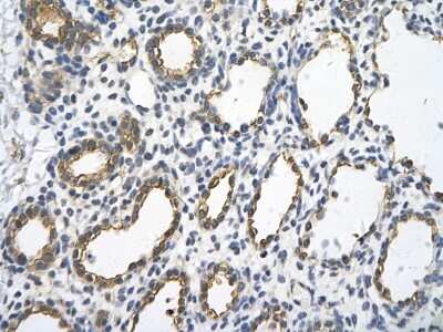 Immunohistochemistry: UBE2J1 Antibody [NBP1-59757] - Paraffin Embedded Tissue: Human alveolar cell Cellular Data: Epithelial cells of renal tubule Antibody Concentration: 4.0 - 8.0 ug/ml Magnification: 400X