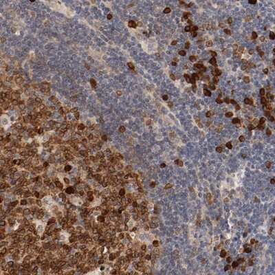 Immunohistochemistry-Paraffin: UBE2J1 Antibody [NBP1-85654] - Staining of human lymph node shows strong cytoplasmic positivity in reaction center cells and lymphoid cells outside reaction centra.