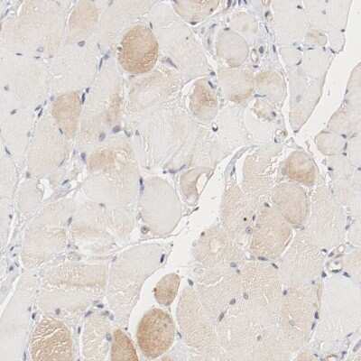 Immunohistochemistry-Paraffin: UBE2J1 Antibody [NBP1-85654] - Staining of human skeletal muscle shows low expression as expected.