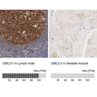 Immunohistochemistry-Paraffin: UBE2J1 Antibody [NBP1-85654] - Analysis in human lymph node and skeletal muscle tissues using NBP1-85654 antibody. Corresponding UBE2J1 RNA-seq data are presented for the same tissues.