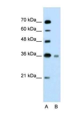 Western Blot: UBE2J1 Antibody [NBP1-59757] - Titration: 2.5ug/ml Positive Control: Jurkat cell lysate.