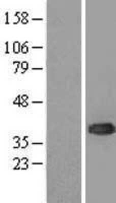 Western Blot: UBE2J1 Overexpression Lysate (Adult Normal) [NBL1-17534] Left-Empty vector transfected control cell lysate (HEK293 cell lysate); Right -Over-expression Lysate for UBE2J1.