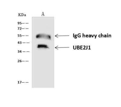 Immunoprecipitation: UBE2J2/UBC6 Antibody [NBP3-06347] - UBE2J1 was immunoprecipitated using:Lane A:0.5 mg Jurkat Whole Cell Lysate4 uL anti-UBE2J1 rabbit polyclonal antibody and 60 ug of Immunomagnetic beads Protein AG. Primary antibody:Anti-UBE2J1 rabbit polyclonal antibody, at 1:100 dilution Secondary antibody:Goat Anti-Rabbit IgG (H+L) HRP at 110000 dilutionDeveloped using the ECL technique.Performed under reducing conditions.Predicted band size: 36 kDaObserved band size: 36 kDa