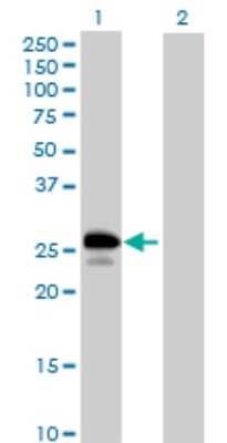 Western Blot: UBE2J2/UBC6 Antibody [H00118424-B01P] - Analysis of UBE2J2 expression in transfected 293T cell line by UBE2J2 polyclonal antibody.  Lane 1: UBE2J2 transfected lysate(28.49 KDa). Lane 2: Non-transfected lysate.